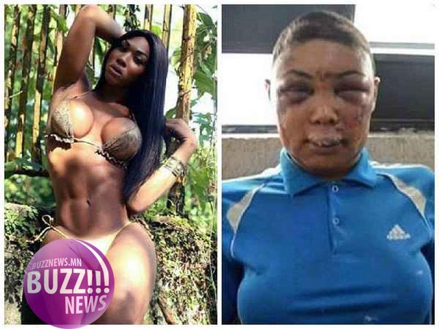 25 настай трансжендэр эмэгтэйг эрэгтэйчүүдийн хориход оруулсан нь хүнлэг явдал уу?